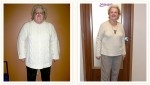 Ann - 110 lbs. Weight Loss