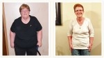 Beverly - 143 lbs. Weight Loss